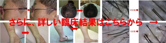 加古川 子宮筋腫 子宮内膜症 卵巣のう腫 子宮腺筋症